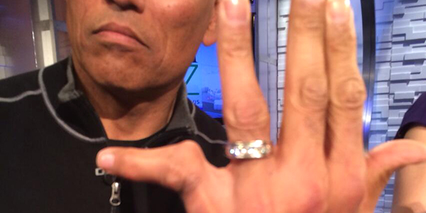 In Case You Forgot, Anthony Muñoz Has An Insanely Messed Up Pinky Finger